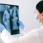 高齡醫師檢查X光片，專業醫療服務，健康管理與疾病預防專家。.