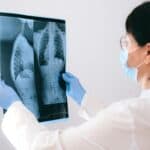 肺部X光醫學檢查，專業醫師分析呼吸道健康狀況，提高外勞健康保障。.